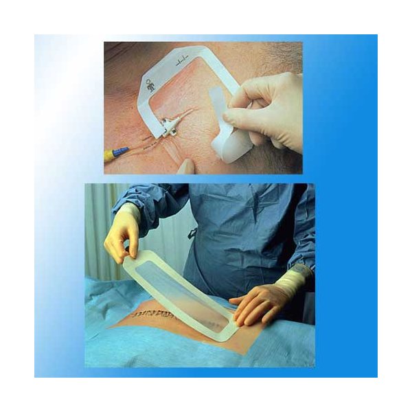 TEGADERM PANS ADH STER 6X7CM 5