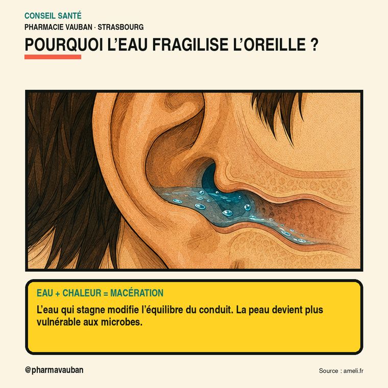 L'otite du baigneur : pourquoi elle arrive après la piscine, et le geste qui l'aggrave sans qu'on le sache. — image 2 sur 8